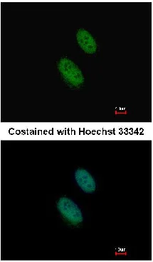 Immunocytochemistry/ Immunofluorescence - Anti-EZH1 antibody - N-terminal (AB137693)