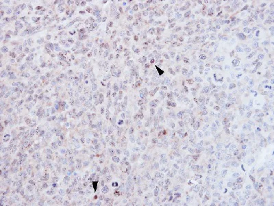 Immunohistochemistry (Formalin/PFA-fixed paraffin-embedded sections) - Anti-EZH1 antibody - N-terminal (AB137693)