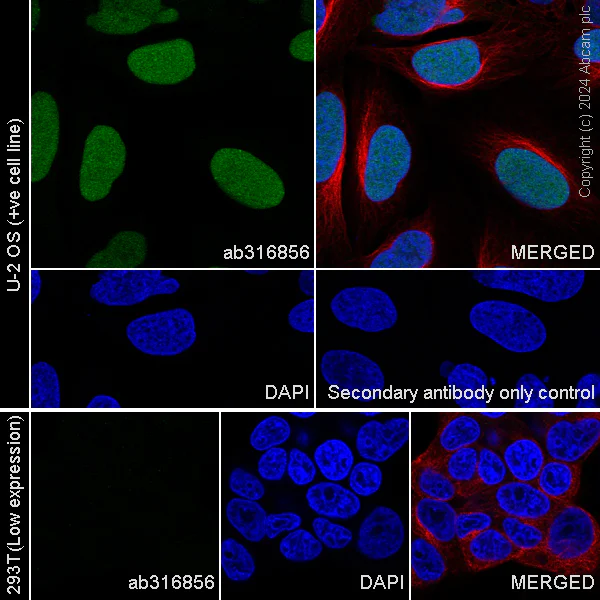 Immunocytochemistry/ Immunofluorescence - Anti-EZHIP antibody [EPR28396-24] - BSA and Azide free (AB316857)