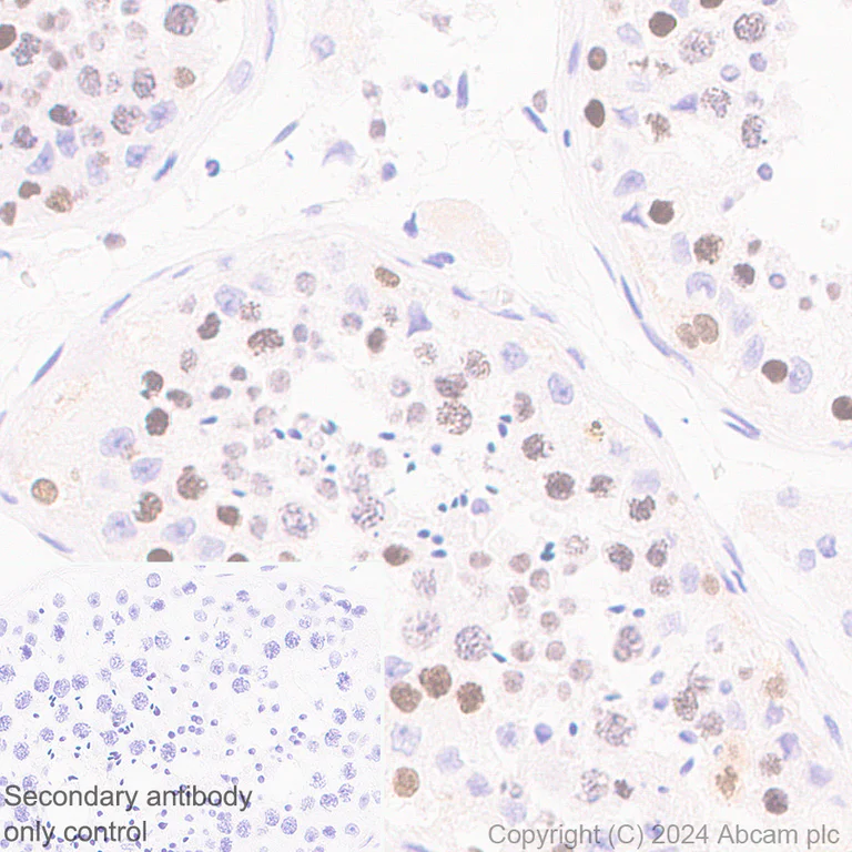 Immunohistochemistry (Formalin/PFA-fixed paraffin-embedded sections) - Anti-EZHIP antibody [EPR28396-24] - BSA and Azide free (AB316857)