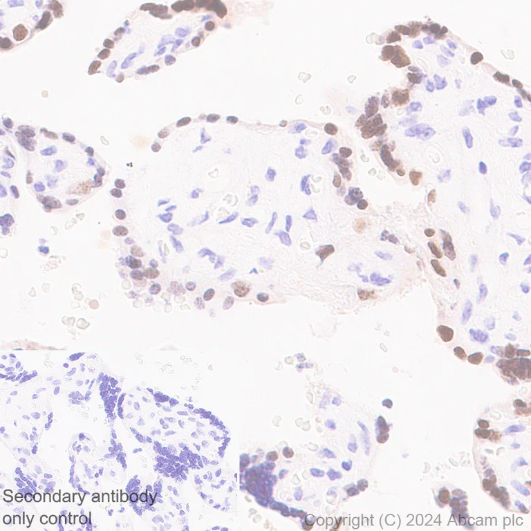 Immunohistochemistry (Formalin/PFA-fixed paraffin-embedded sections) - Anti-EZHIP antibody [EPR28396-24] - BSA and Azide free (AB316857)