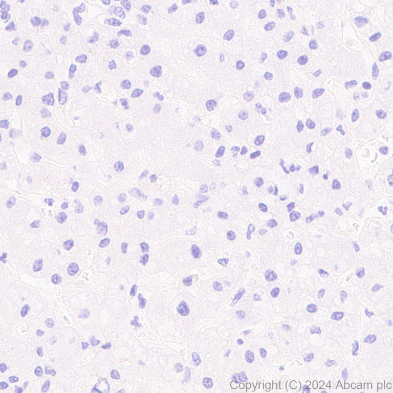 Immunohistochemistry (Formalin/PFA-fixed paraffin-embedded sections) - Anti-EZHIP antibody [EPR28396-24] - BSA and Azide free (AB316857)