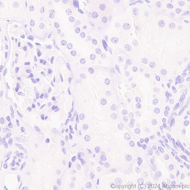 Immunohistochemistry (Formalin/PFA-fixed paraffin-embedded sections) - Anti-EZHIP antibody [EPR28396-24] - BSA and Azide free (AB316857)