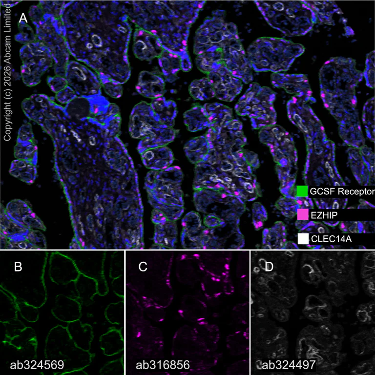 Multiplex immunohistochemistry - Anti-EZHIP antibody [EPR28396-24] - BSA and Azide free (AB316857)