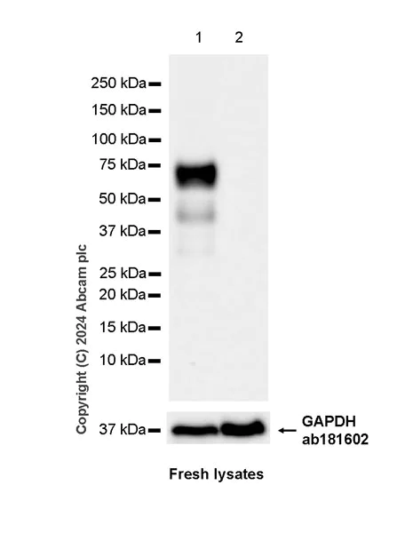 Western blot - Anti-EZHIP antibody [EPR28396-24] - BSA and Azide free (AB316857)