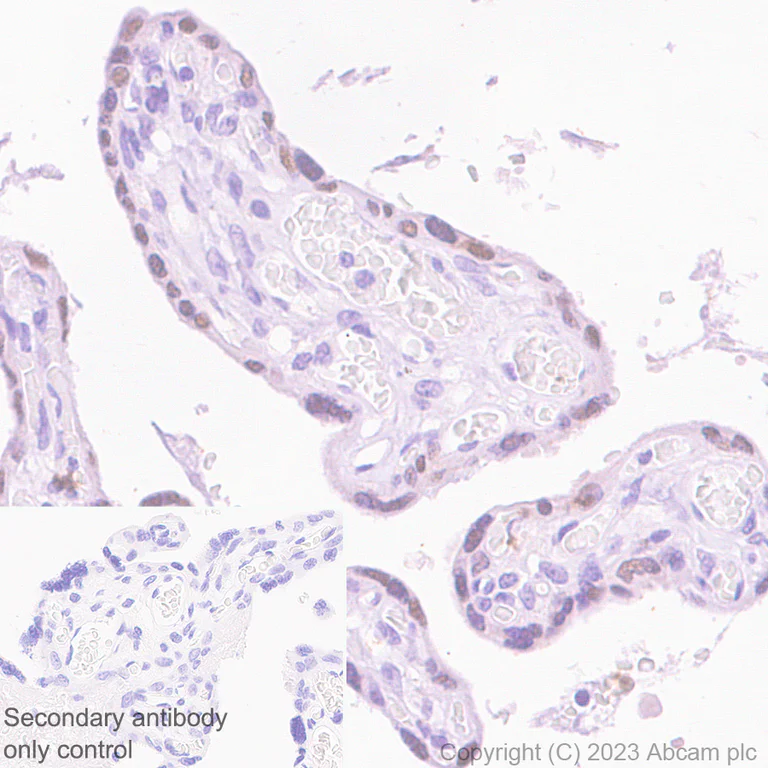 Immunohistochemistry (Formalin/PFA-fixed paraffin-embedded sections) - Anti-EZHIP antibody [EPR28396-50] (AB313392)