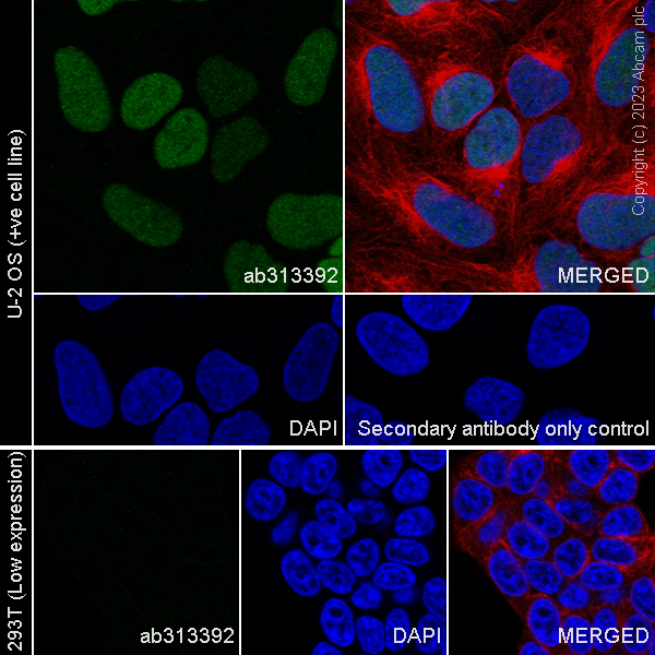 Immunocytochemistry/ Immunofluorescence - Anti-EZHIP antibody [EPR28396-50] - BSA and Azide free (AB313393), expandable thumbnail