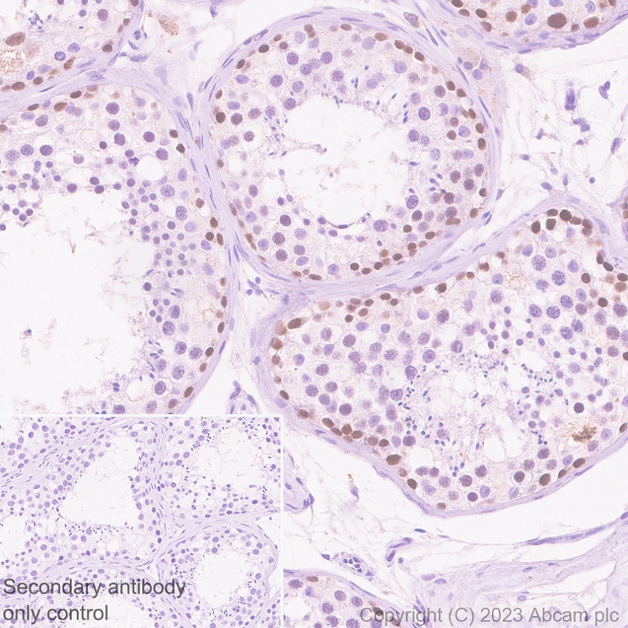 Immunohistochemistry (Formalin/PFA-fixed paraffin-embedded sections) - Anti-EZHIP antibody [EPR28396-50] - BSA and Azide free (ab313393), expandable thumbnail