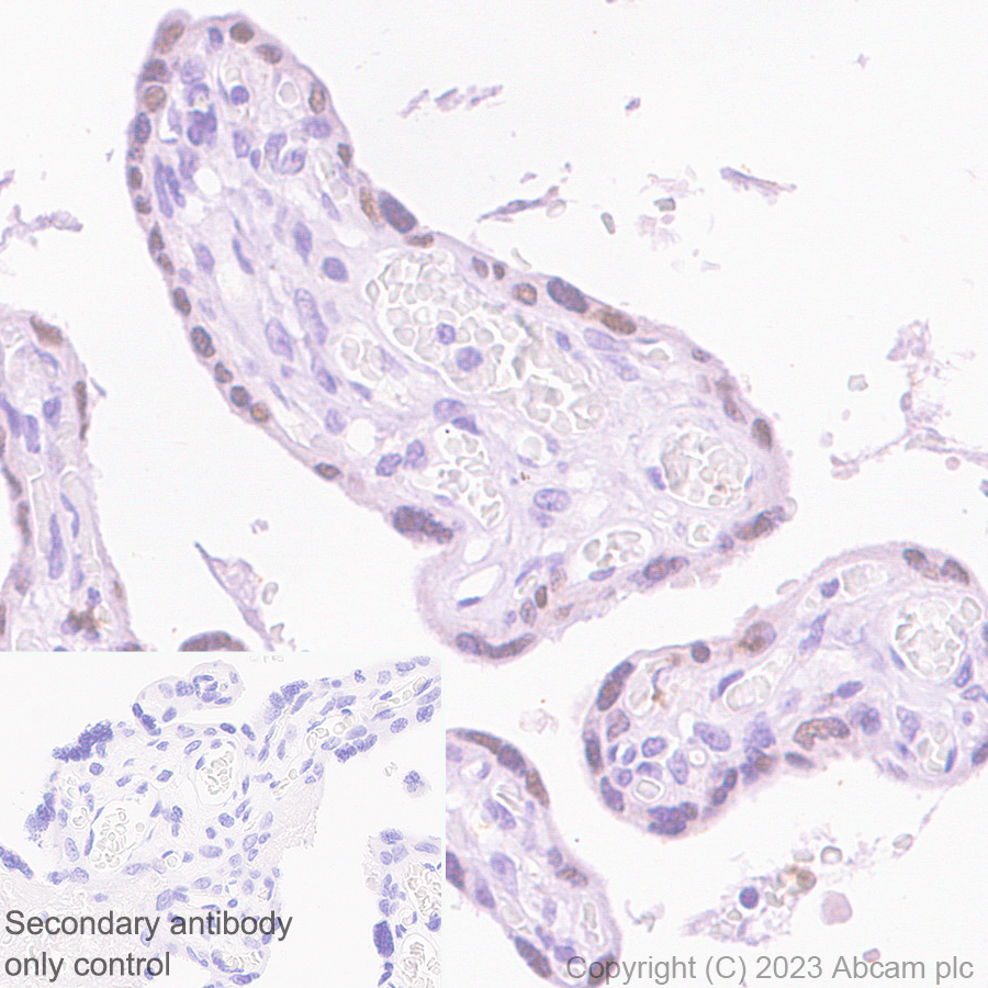Immunohistochemistry (Formalin/PFA-fixed paraffin-embedded sections) - Anti-EZHIP antibody [EPR28396-50] - BSA and Azide free (ab313393), expandable thumbnail