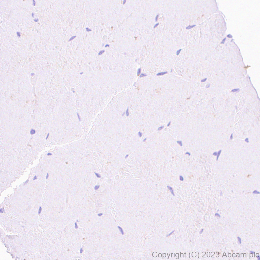 Immunohistochemistry (Formalin/PFA-fixed paraffin-embedded sections) - Anti-EZHIP antibody [EPR28396-50] - BSA and Azide free (AB313393), expandable thumbnail