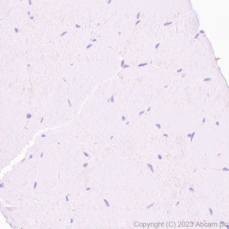 Immunohistochemistry (Formalin/PFA-fixed paraffin-embedded sections) - Anti-EZHIP antibody [EPR28396-50] - BSA and Azide free (AB313393)