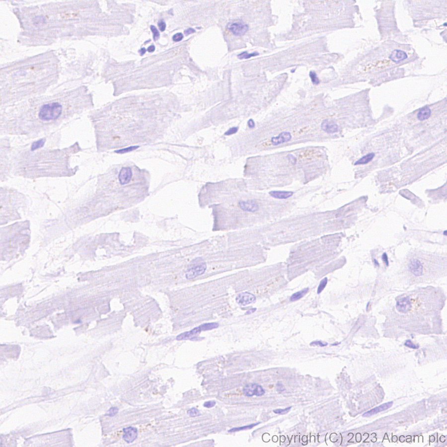 Immunohistochemistry (Formalin/PFA-fixed paraffin-embedded sections) - Anti-EZHIP antibody [EPR28396-50] - BSA and Azide free (AB313393), expandable thumbnail