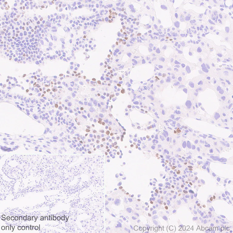Immunohistochemistry (Formalin/PFA-fixed paraffin-embedded sections) - Anti-EZHIP antibody [EPR28397-58] (AB316157)