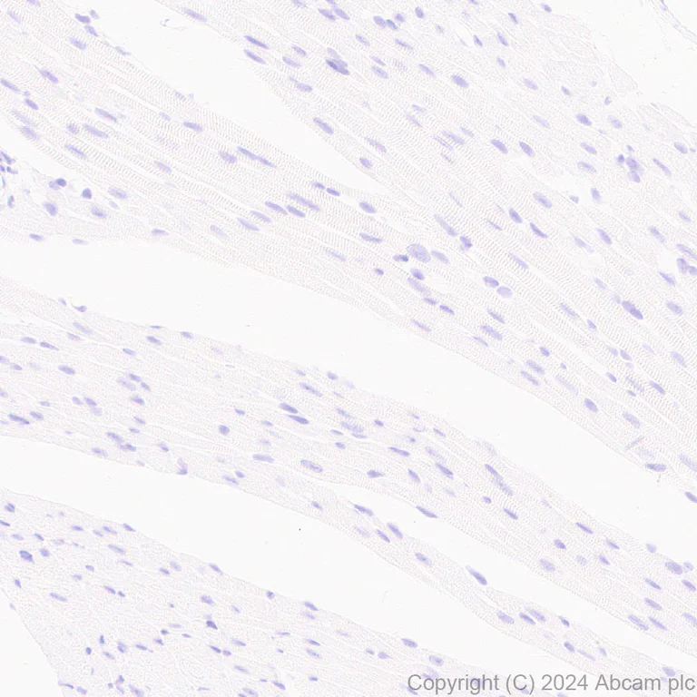 Immunohistochemistry (Formalin/PFA-fixed paraffin-embedded sections) - Anti-EZHIP antibody [EPR28397-58] (AB316157)