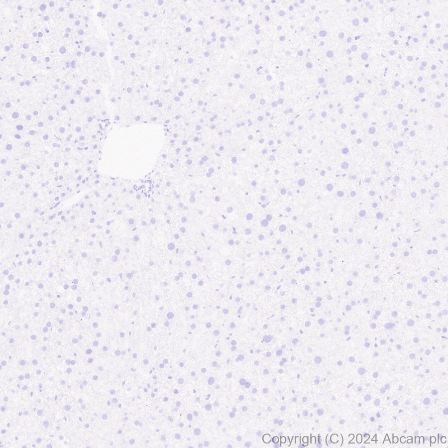 Immunohistochemistry (Formalin/PFA-fixed paraffin-embedded sections) - Anti-EZHIP antibody [EPR28397-58] (AB316157), expandable thumbnail