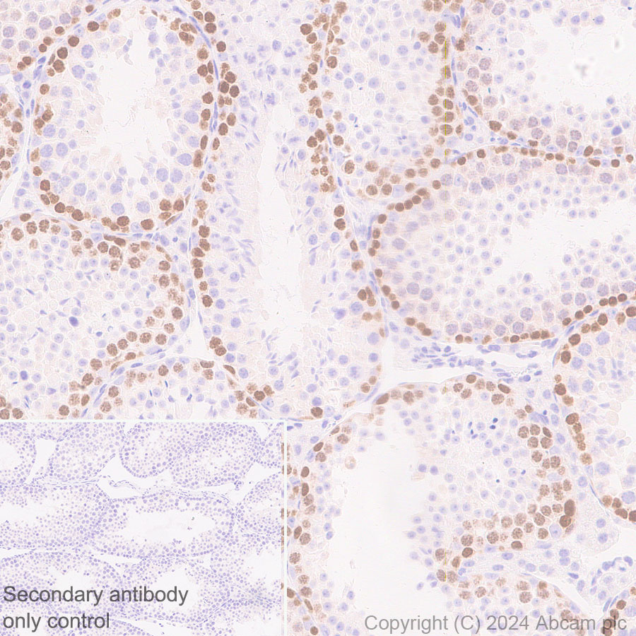 Immunohistochemistry (Formalin/PFA-fixed paraffin-embedded sections) - Anti-EZHIP antibody [EPR28397-58] - BSA and Azide free (AB316158), expandable thumbnail