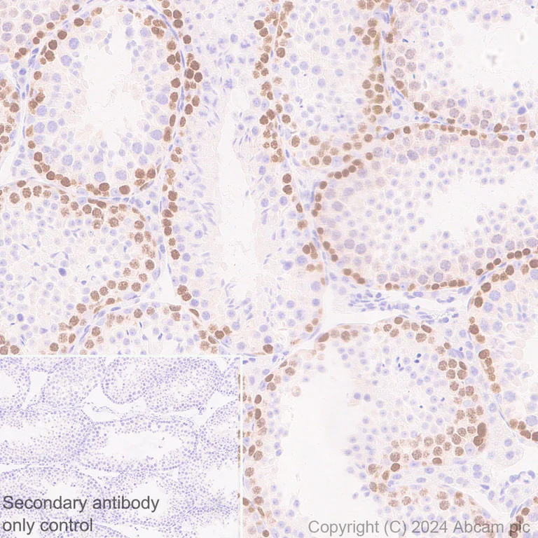 Immunohistochemistry (Formalin/PFA-fixed paraffin-embedded sections) - Anti-EZHIP antibody [EPR28397-58] - BSA and Azide free (AB316158)