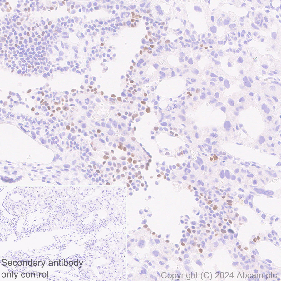 Immunohistochemistry (Formalin/PFA-fixed paraffin-embedded sections) - Anti-EZHIP antibody [EPR28397-58] - BSA and Azide free (AB316158), expandable thumbnail