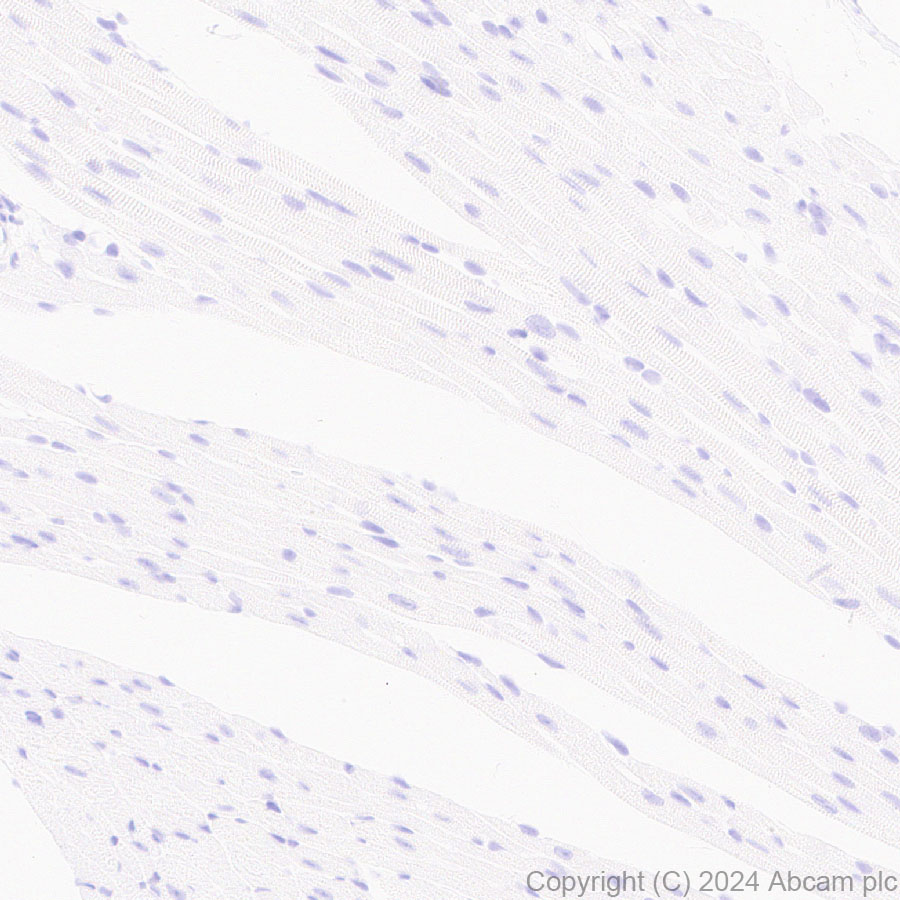 Immunohistochemistry (Formalin/PFA-fixed paraffin-embedded sections) - Anti-EZHIP antibody [EPR28397-58] - BSA and Azide free (AB316158), expandable thumbnail