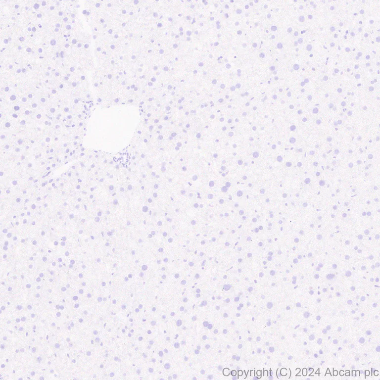 Immunohistochemistry (Formalin/PFA-fixed paraffin-embedded sections) - Anti-EZHIP antibody [EPR28397-58] - BSA and Azide free (AB316158)