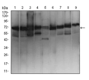 Western blot - Anti-Ezrin antibody [6F1A9] (AB205381)