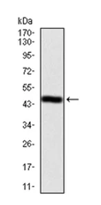 Western blot - Anti-Ezrin antibody [6F1A9] (AB205381)