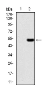 Western blot - Anti-Ezrin antibody [6F1A9] (AB205381)