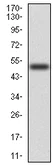 Western blot - Anti-Ezrin antibody [6F1C3] (AB204954)