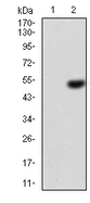 Western blot - Anti-Ezrin antibody [6F1C3] (AB204954)