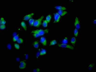 Immunocytochemistry/ Immunofluorescence - Anti-Ezrin antibody (AB235927)