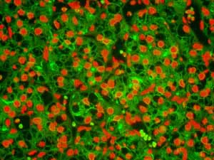 Immunohistochemistry (Formalin/PFA-fixed paraffin-embedded sections) - Anti-Ezrin antibody [EP886Y] - BSA and Azide free (AB239832)