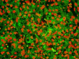 Immunohistochemistry (Formalin/PFA-fixed paraffin-embedded sections) - Anti-Ezrin antibody [EP886Y] - Plasma Membrane Marker (ab40839), expandable thumbnail