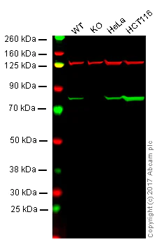Western blot - Anti-Ezrin antibody [EP886Y] - Plasma Membrane Marker (AB40839)