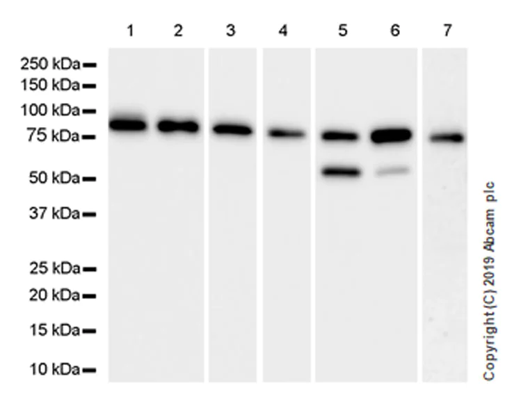 Western blot - Anti-Ezrin antibody [EPR23353-55] (AB270442)