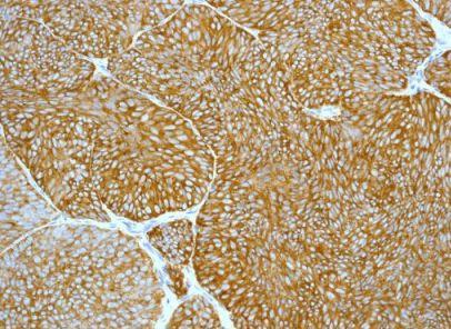 Immunohistochemistry (Formalin/PFA-fixed paraffin-embedded sections) - Anti-Ezrin antibody [EPR803] (AB133297), expandable thumbnail