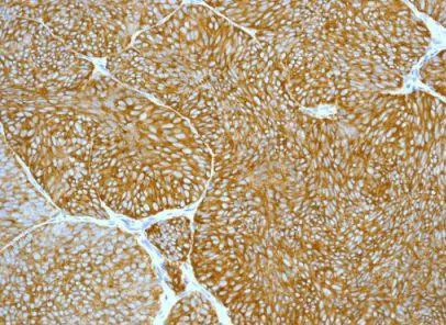Immunohistochemistry (Formalin/PFA-fixed paraffin-embedded sections) - Anti-Ezrin antibody [EPR803] (AB133297)