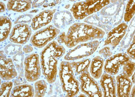 Immunohistochemistry (Formalin/PFA-fixed paraffin-embedded sections) - Anti-Ezrin antibody [EPR803] (AB133297)