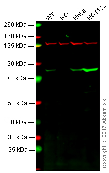 Western blot - Anti-Ezrin antibody [EPR803] (AB133297), expandable thumbnail