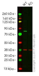 Western blot - Anti-Ezrin antibody [EPR803] (AB133297), expandable thumbnail