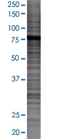 SDS-PAGE - Ezrin overexpression 293T lysate (whole cell) (AB94091)