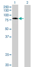 Western blot - Ezrin overexpression 293T lysate (whole cell) (AB94091)
