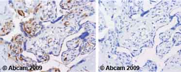 Anti-Ezrin (phospho T567) antibody (ab47293) | Abcam