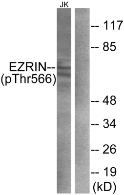 Anti-Ezrin (phospho T567) antibody (ab47293) | Abcam