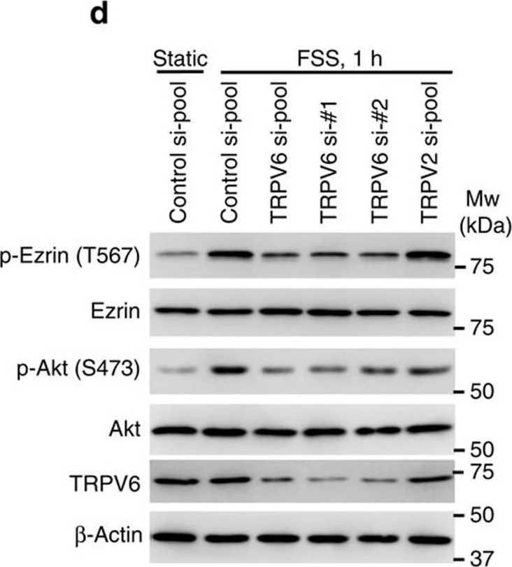 Western blot - Anti-Ezrin (phospho T567) antibody (AB47293)