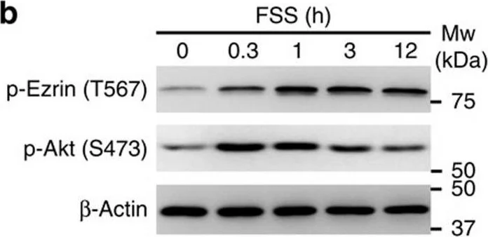 Western blot - Anti-Ezrin (phospho T567) antibody (AB47293)