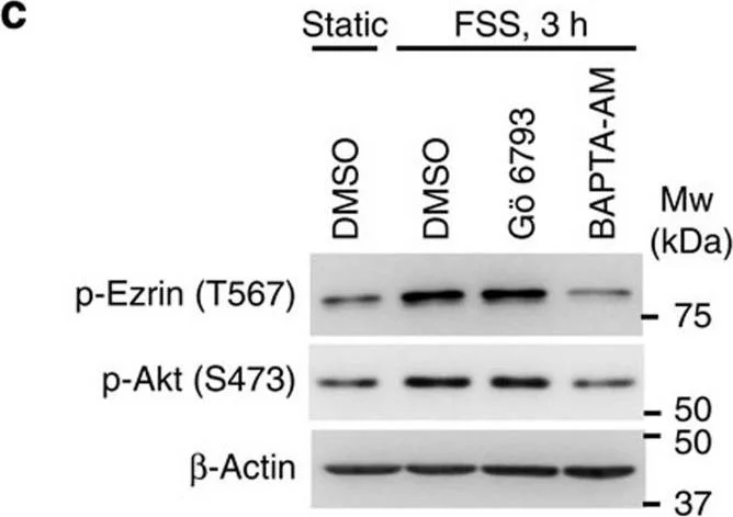 Western blot - Anti-Ezrin (phospho T567) antibody (AB47293)