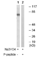 Western blot - Anti-Ezrin (phospho Y478) antibody (AB79256)