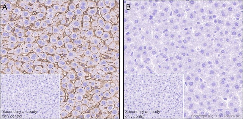 Immunohistochemistry (Formalin/PFA-fixed paraffin-embedded sections) - Anti-Ezrin (pThr567)/ Radixin (pThr564)/ Moesin (pThr558) antibody [EP2122Y] (ab76247), expandable thumbnail
