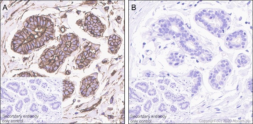 Immunohistochemistry (Formalin/PFA-fixed paraffin-embedded sections) - Anti-Ezrin (pThr567)/ Radixin (pThr564)/ Moesin (pThr558) antibody [EP2122Y] (AB76247), expandable thumbnail