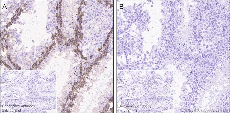Anti-Ezrin (pThr567)/ Radixin (pThr564)/ Moesin (pThr558) antibody